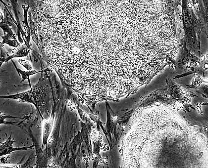 美</td></tr></table>科学家揭秘:干细胞何以“青春永驻”