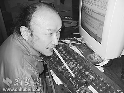 四肢瘫痪的曹一钢 用头部力量玩转电脑(图)