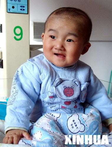 国内首例婴幼儿心脏移植手术在济南成功实施(