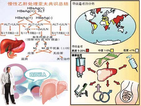 乙肝患者的全球分布图及传染途径
