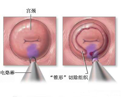 å®«é¢è¥å¤§æä¹æ²»ç