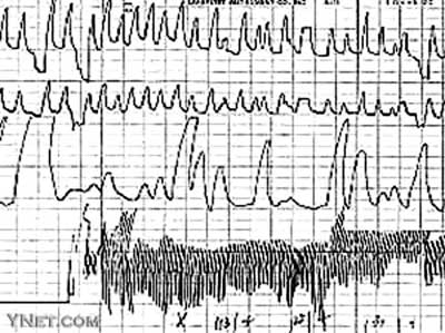 人口的变化_DOC空间变化 DOC格式空间变化素材图片 DOC空间变化设计模板 我图网(3)