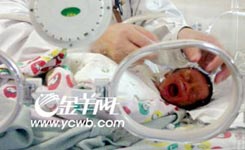 兔唇胎儿遭引产 网友批评漠视生命-搜狐新闻