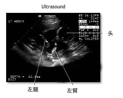 怀孕手册 怀孕 孕期保健 孕期检查  由于显示在屏幕上仅是不大清晰的