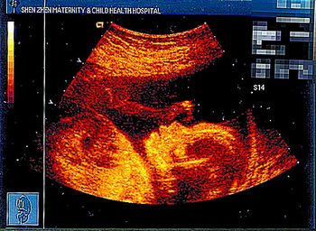 医院卖可辨性别胎儿写真-(图)