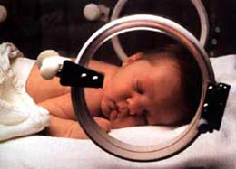 新生宝宝护理经验20条