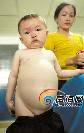 南海网2月28日消息:2岁半的小男孩秦亚弟总是叫着肚子疼,他吃饭比
