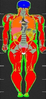 人体脂肪分布图(绿色为体表脂肪,黄色为体内脂肪,红色为肌肉)