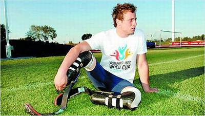 南非无腿飞人梦想2008 欲当首个参加奥运残疾人