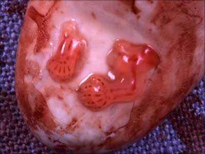 不同时期堕胎的胎儿(组图)