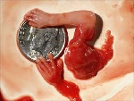不同时期堕胎胎儿图