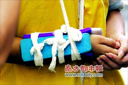 断臂的少年:离乡"闯世界"却成了"撞车党"