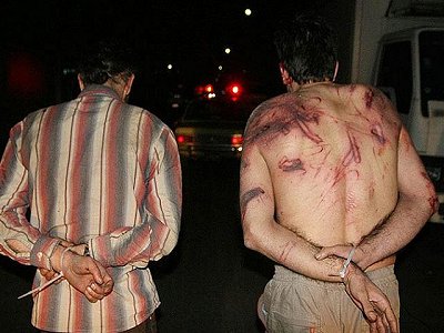 被捕者背部裸露显示伤痕