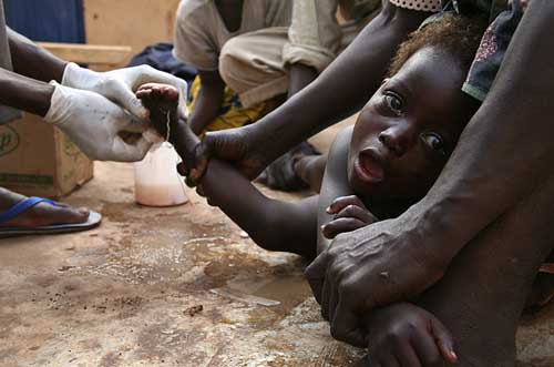 怪虫肆虐非洲 无数儿童染病丧失行动能力(组图)