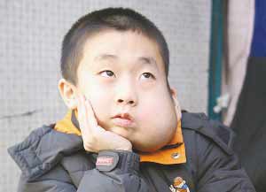 8岁男孩脸上长1公斤肿瘤 两次手术两次复发(图