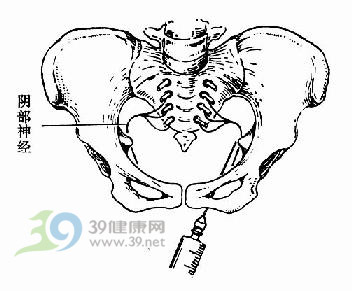 顺产私处侧切手术详解(图)