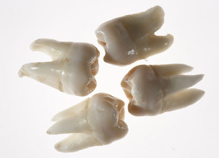 日本科学家垃圾箱里拣牙齿培养干细胞