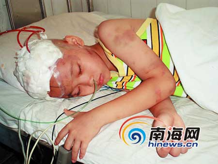 7岁幼童被陌生男子掳走敲碎脑门 生命垂危(图)