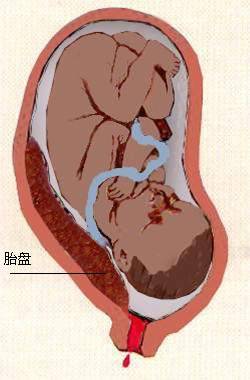 胎盘在这个位置上的需要进行剖腹产手术.