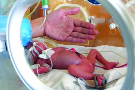托起的"袖珍女婴",于17天前在滨州医学院附属医院诞生,出生体重仅为0
