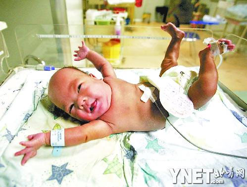 第一袖珍宝宝出院 体重从550克升至4斤(图)