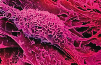美最新研究发现:骨髓干细胞可用来治疗心脏病