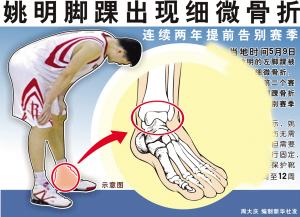 脚踝骨裂症状:局部疼痛 姚明可用拍片检查(图)