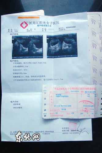 黑龙江阳光女子医院给记者开具的b超报告单