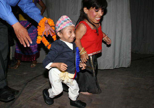 尼泊尔小伙成世界上最矮的人