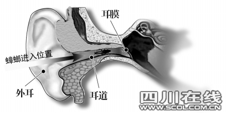 蟑螂半夜钻进耳朵 男子灌水手掏未果险失聪(图) - 野逸*蔷薇 - 智慧