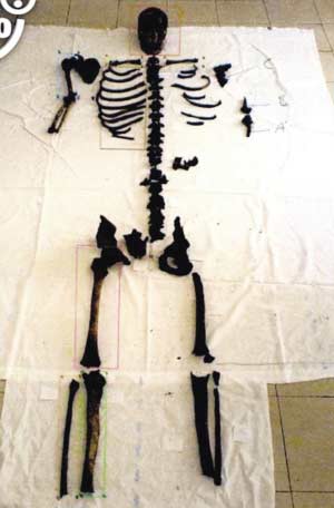 罗马5人尸骨拼出一副骨架 案发两年多仍是谜团