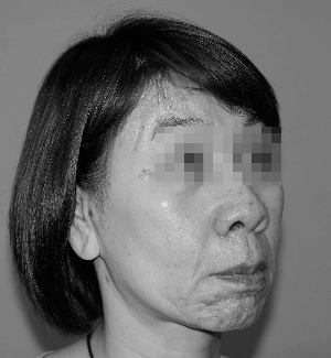 妙龄女孩患上衰老症 医生建议查染色体(图)