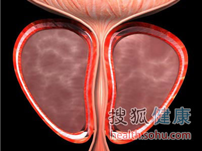 发现“疑似癌”怎么办？14个癌前表现