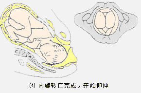 图解胎儿如何经过产道?