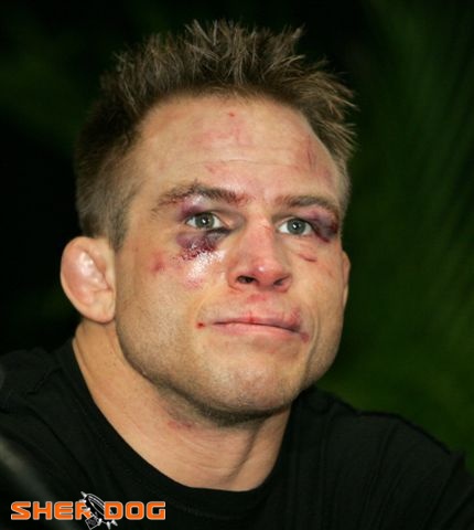 组图:UFC都是脸上伤痕惊人 浴血奋战不言放弃