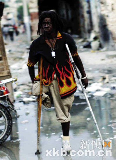 9月29日，在海地首都太子港市区，一名男子拄着拐杖等待穿越马路。