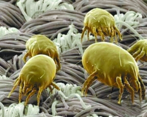 显微镜下的螨虫真容。资料图片