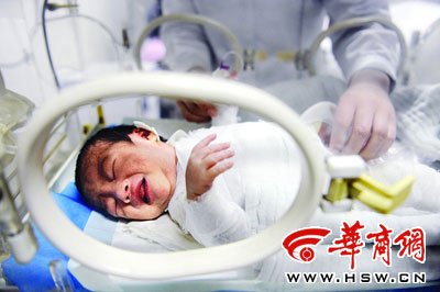 在重症监护室，小宝宝全身包裹着纱布，还未脱离危险 本报记者 赵彬 摄