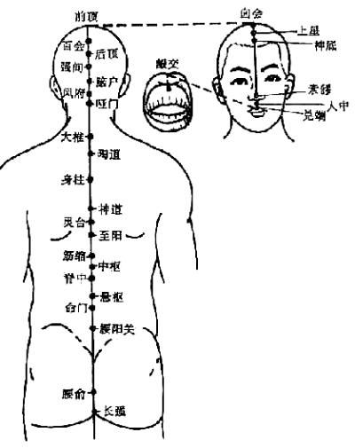艾灸疗法的适应症之颈椎病(组图)