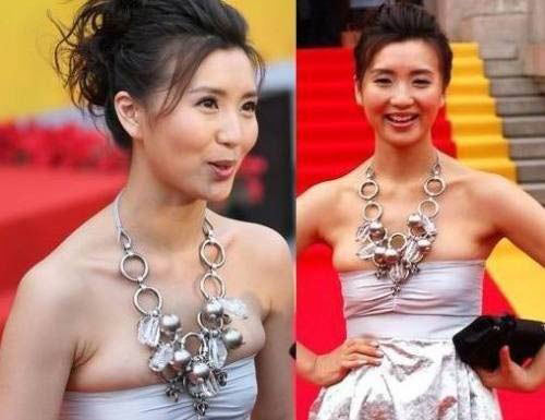 女星拼性感露胸成悲剧 宫雪花真空上阵现疤痕(组图)