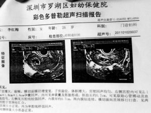 怀双胞胎孕妇称因医院误诊两度被流产(组图)