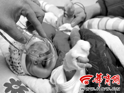 早产男婴儿出生仅13天 医院内手指莫名变黑(图)