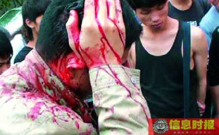 广州交通执法屡遭暴力抗法 的哥打爆执法人员头