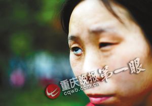 9岁女童右眼被刺瞎 "眼珠"经常滚落出来(图)