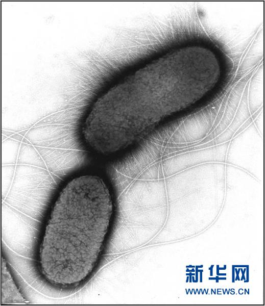 这是5月30日德国罗伯特·科赫研究所提供的肠出血性大肠杆菌的电子显微镜照片。新华社/法新