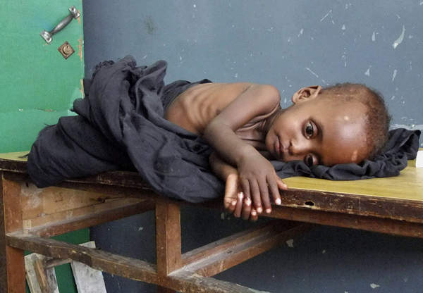 【图】东非50万儿童遭"死亡威胁"