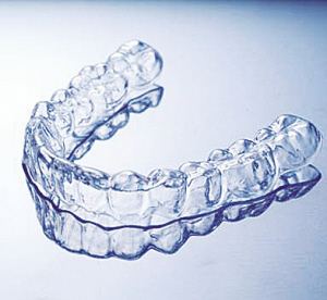 牙颌畸形的无托槽隐形矫治(组图)