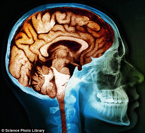 科学家发现只有人类大脑会随年龄增长而萎缩-