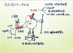 博士生医学漫画走红网络- 复习笔记用蜘蛛侠象