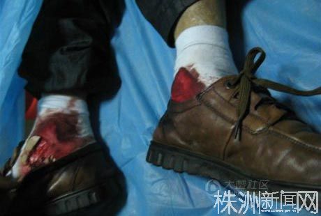 网传襄阳官员被挑断脚筋扔下四楼 警方通报称系自杀(组图)